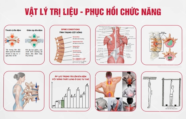Vật lý trị liệu phục hồi chức năng