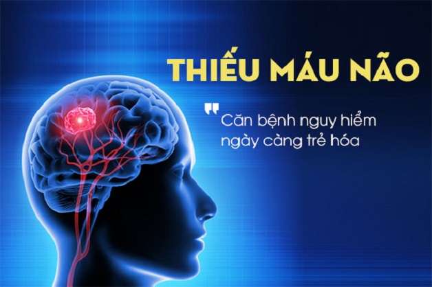 thiếu máu não
