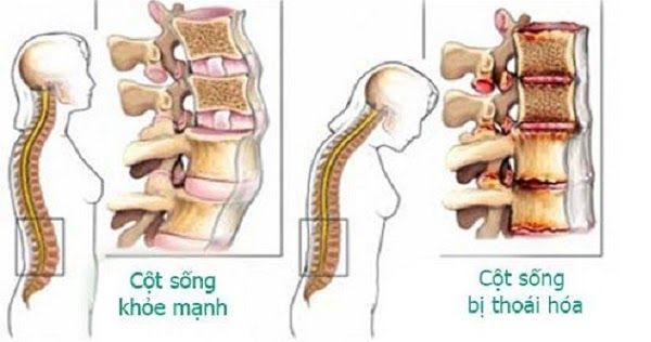 vai trò cột sống